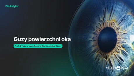 Od znamion do czerniaka: spektrum nowotworów powierzchni oka